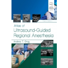  Atlas of Ultrasound-Guided Regional Anesthesia – Andrew T. Gray idegen nyelvű könyv