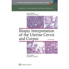  Biopsy Interpretation of the Uterine Cervix and Corpus – Anais Malpica,Elizabeth D. Euscher idegen nyelvű könyv