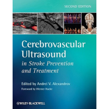 Cerebrovascular Ultrasound in Stroke Prevention and Treatment 2e – Andrei V Alexandrov idegen nyelvű könyv