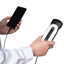 CHISON SONOEYE P5 colour + PW orvosi diagnosztikus ultrahang gyógyhatású készítmény