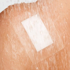  CURAPOR TRANSPARENT vízálló szigetkötszer 10x25cm gyógyászati segédeszköz