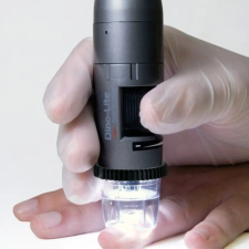  DinoLite CapillaryScope 500 PRO kapilláris mikroszkóp gyógyászati segédeszköz