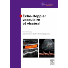 Echo-Doppler vasculaire et viscéral – Marie-France Bellin,Paul Legmann idegen nyelvű könyv