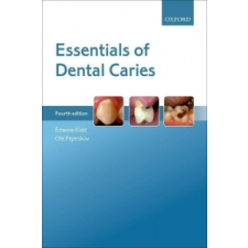  Essentials of Dental Caries – Edwina A. M. Kidd,Ole Fejerskov idegen nyelvű könyv