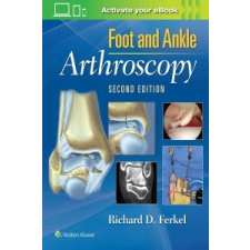  Foot & Ankle Arthroscopy – Richard D Ferkel idegen nyelvű könyv