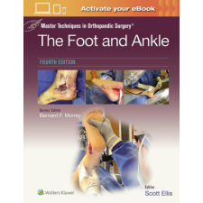 Master Techniques in Orthopaedic Surgery: The Foot and Ankle – SCOTT ELLIS idegen nyelvű könyv