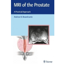  MRI of the Prostate – Andrew Rosenkrantz idegen nyelvű könyv