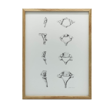 NYAKI csigolyák ANATÓMIAI PLAKÁT ANATÓMIÁJA FALHOZ 50x70 CM ARANY KERET grafika, keretezett kép