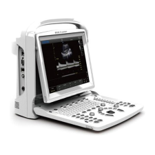  Orvosi diagnosztikus ultrahang CHISON ECO3 EXP. B&W + PW gyógyászati segédeszköz