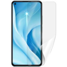 SCREENSHIELD XIAOMI 11 Lite 5G NE kijelzővédő fólia (XIA-11LT5GNE-D) mobiltelefon kellék