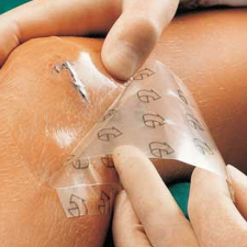  SUPRASORB F 5 X 7 CM hydrogél film kötszer gyógyászati segédeszköz