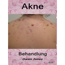 Tektime Akne-Behandlung egyéb e-könyv