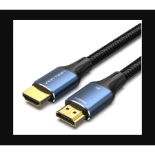 Vention ALGLG HDMI 2.1 - HDMI 2.1 Kábel 1.5m - Fekete kábel és adapter