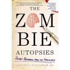  Zombie Autopsies – Steven C. Schlozman idegen nyelvű könyv
